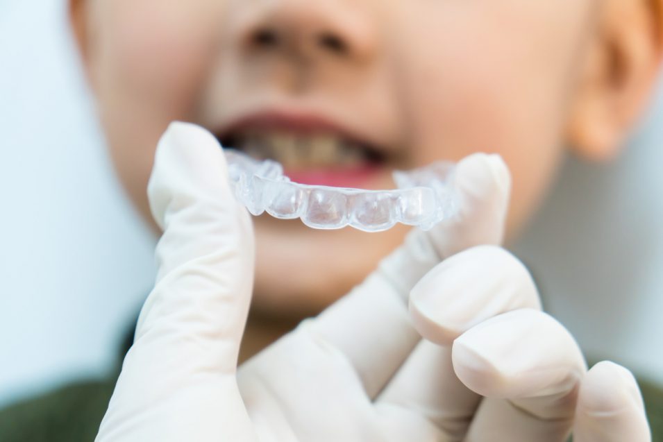 Check a retainer