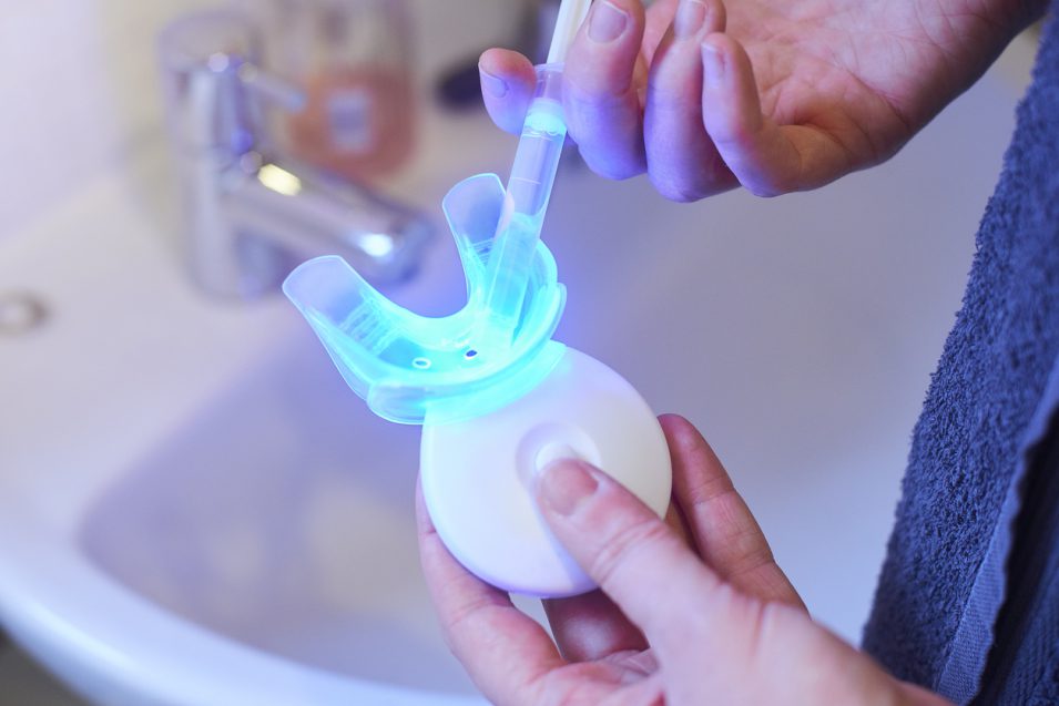 teeth whitening near you Our dentist providing teeth whitening near you