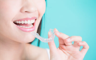 5 Reasons To Choose Invisalign