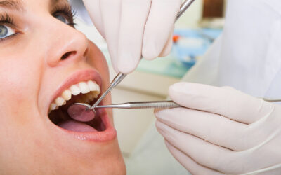 What Should You Know About Root Canals?