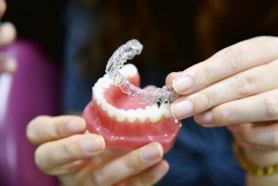 clear aligner therapy near you Dentist providing clear aligner therapy near you
