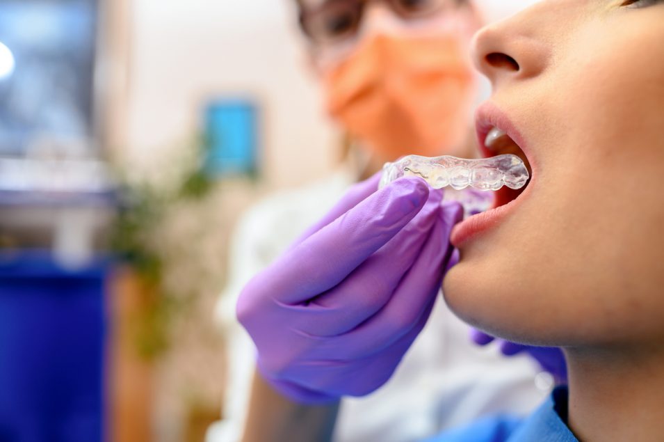 invisalign in north york Patient getting invisalign in North York