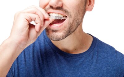 Clear Aligners vs. Invisalign®: What’s the Difference?